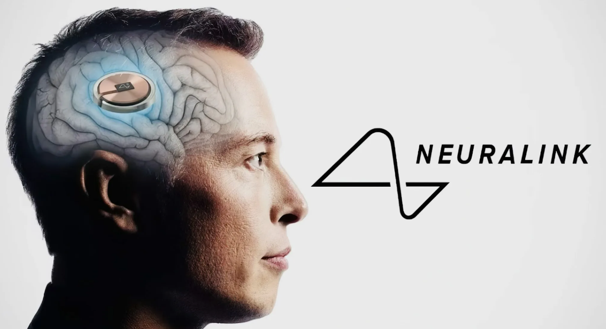 Neuralink успешно внедрил нейроимплант в мозг второго пациента